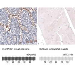 NHE3/SLC9A3 Antibody, Novus Biologicals 25 &mu;L | Buy Online | Novus Biologicals (Bio-Techne) | Fisher Scientific